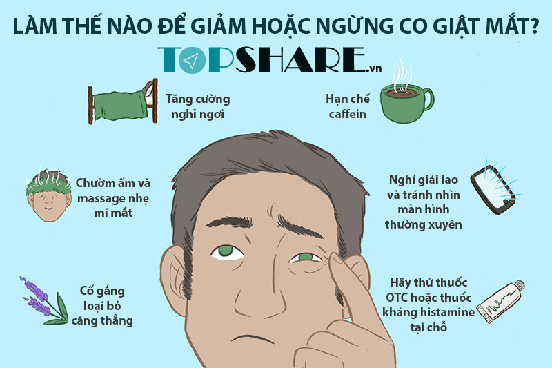 Giải Mã Giật Mắt Phải Hay Nháy Mắt Phải ở Nam Nữ Theo Quan Niệm Khoa Học