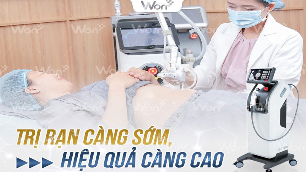 Trị rạn da bằng công nghệ Matrix Plus tại Won Clinic có tốt như quảng cáo? 5 Trị rạn da bằng công nghệ Matrix Plus tại Won Clinic có tốt như quảng cáo?
