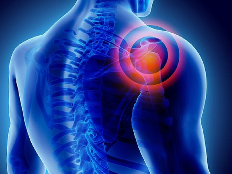 6 nguy cơ chấn thương khi chơi cầu lông & Cách xử lý hiệu quả 18 chấn thương khi chơi cầu lông