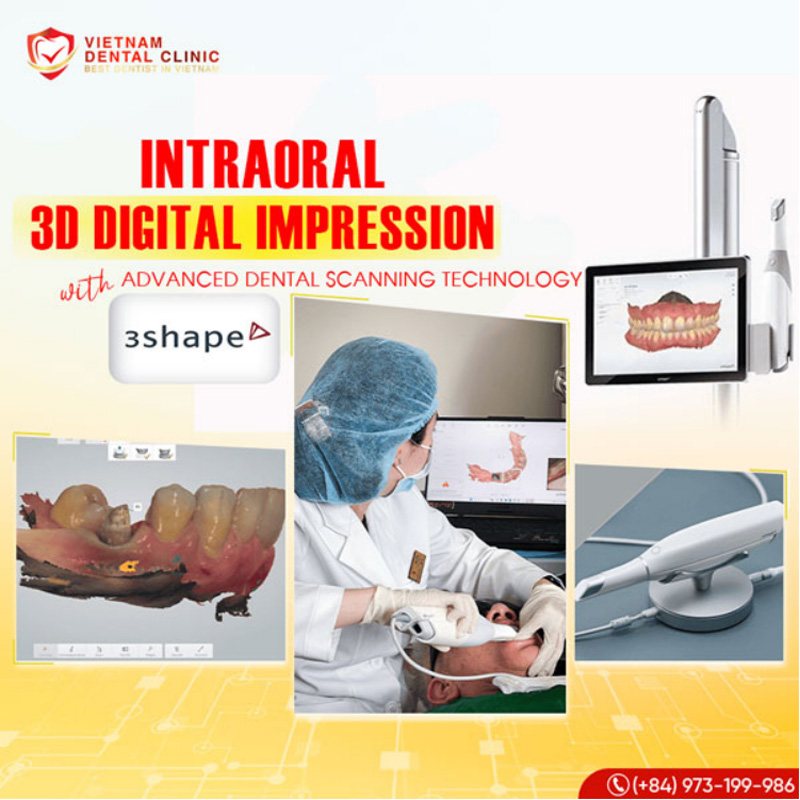 Why Saigon Center Dental Clinic is becoming a top dental tourism destination for Australians and Americans 5